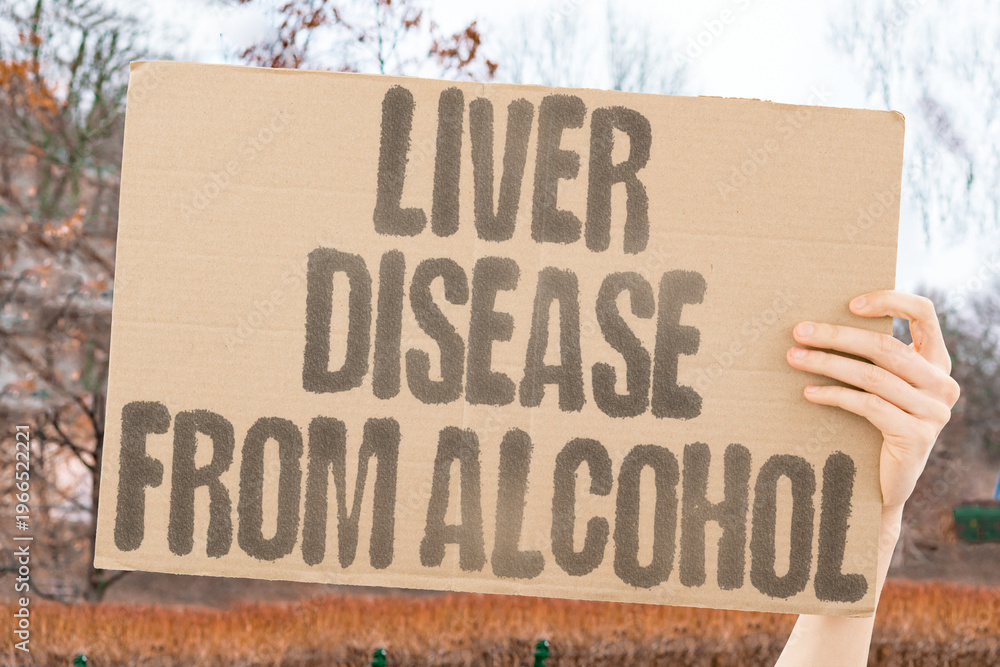 "Liver disease from alcohol" Liver disease from alcohol progresses through distinct worsening stages. LIVER. STAGES. ALCOHOL. DISEASE. PROGRESSION.